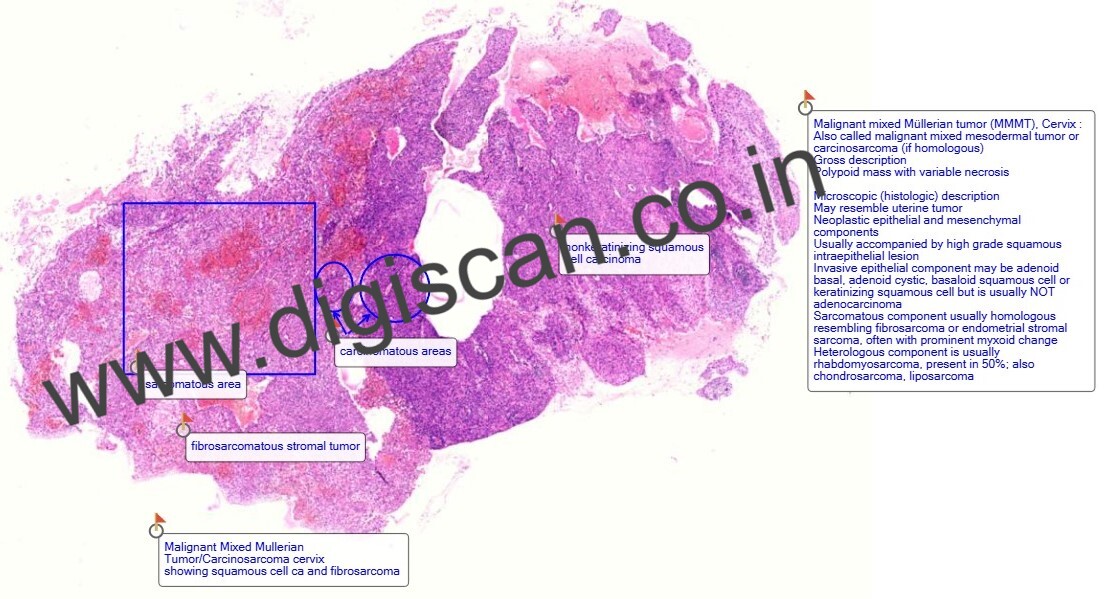 Digital Histopathology Slide Sets (With Annotated Histology Slides)